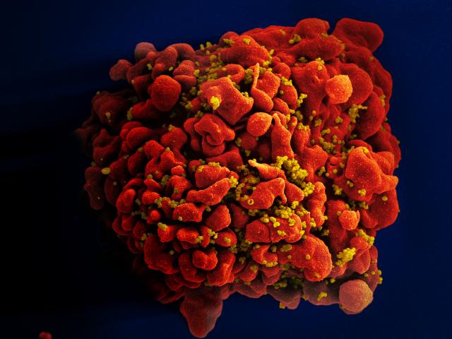 A human T cell infected by numerous HIV particles. (Source: NIAID)